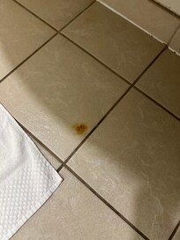 Looks like cigarette burn or something