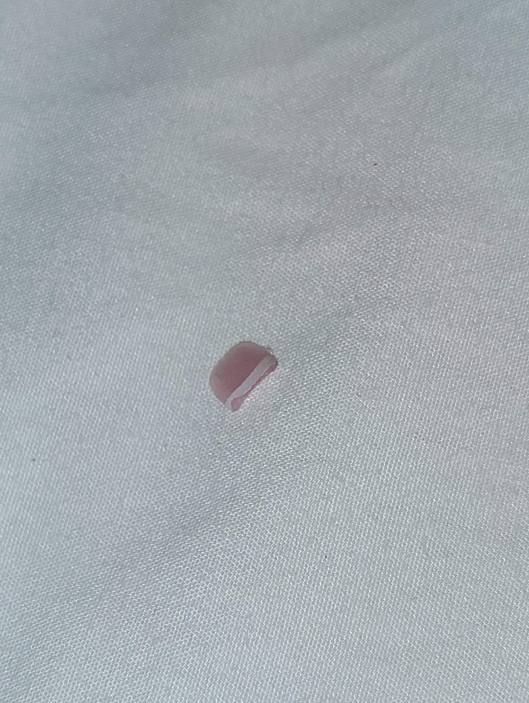 Finger nail in bed firstd room