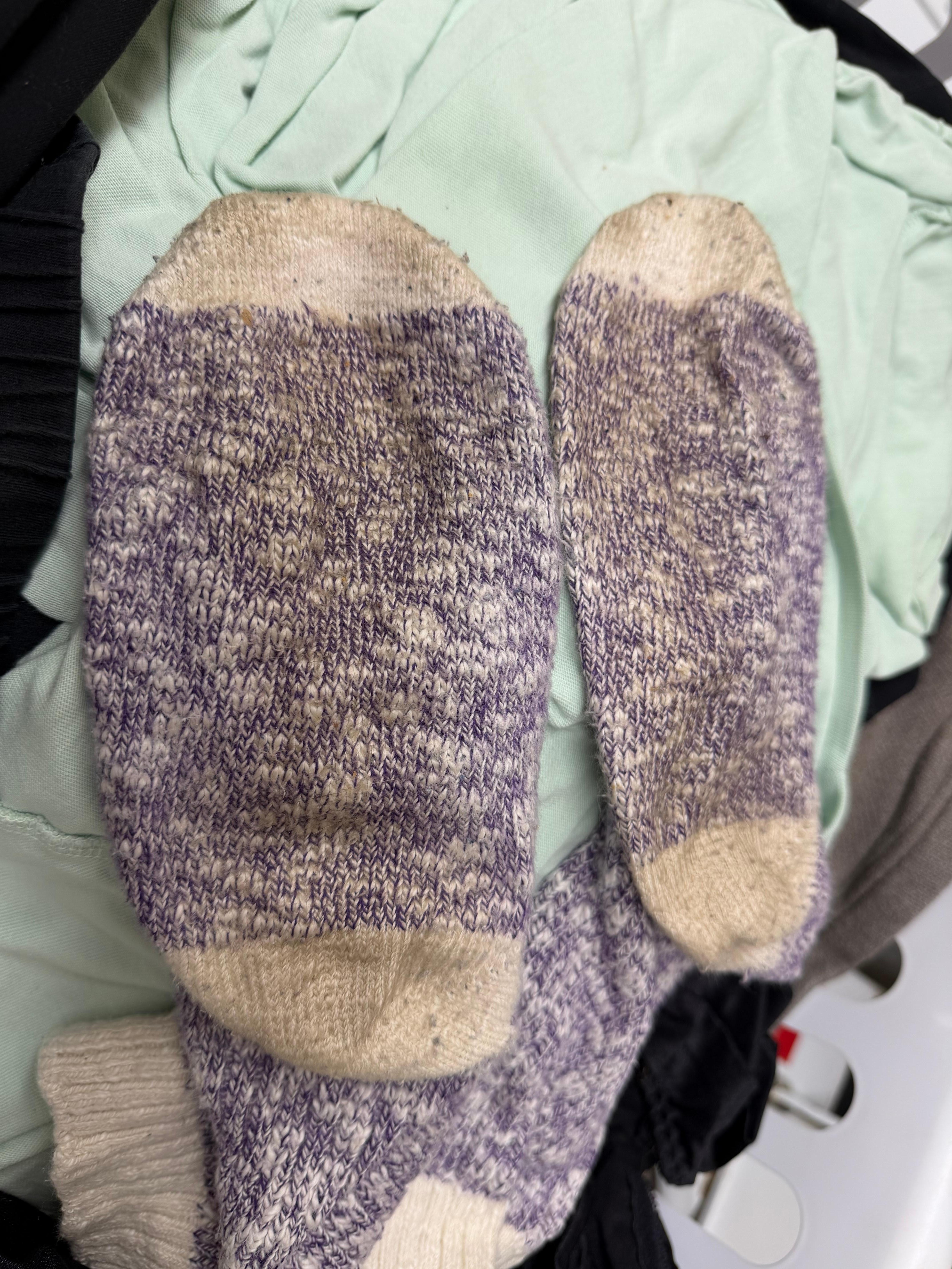 Filth on socks from floors