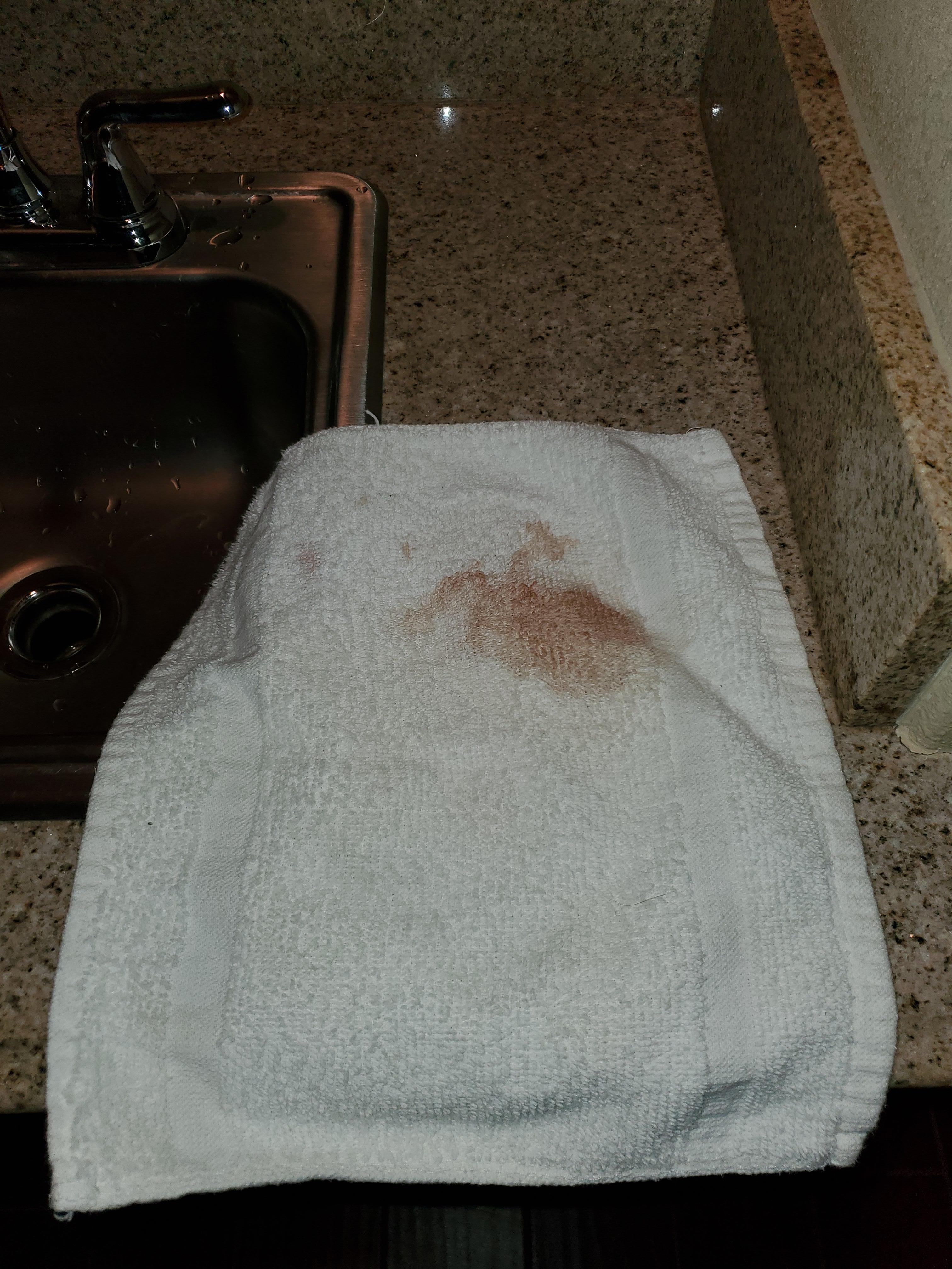 Bloody wash cloth.