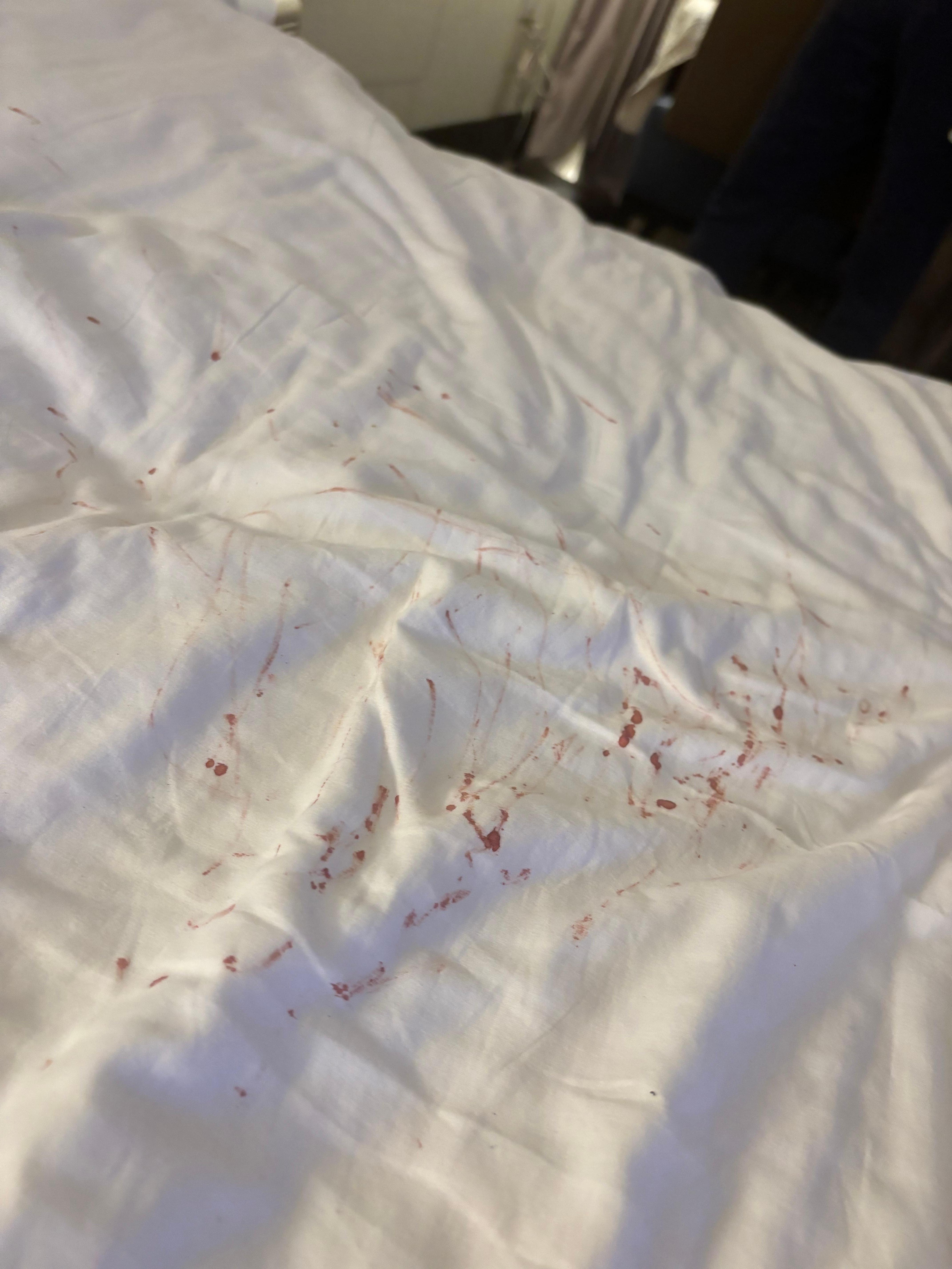 Bloody sheets put on during linen change