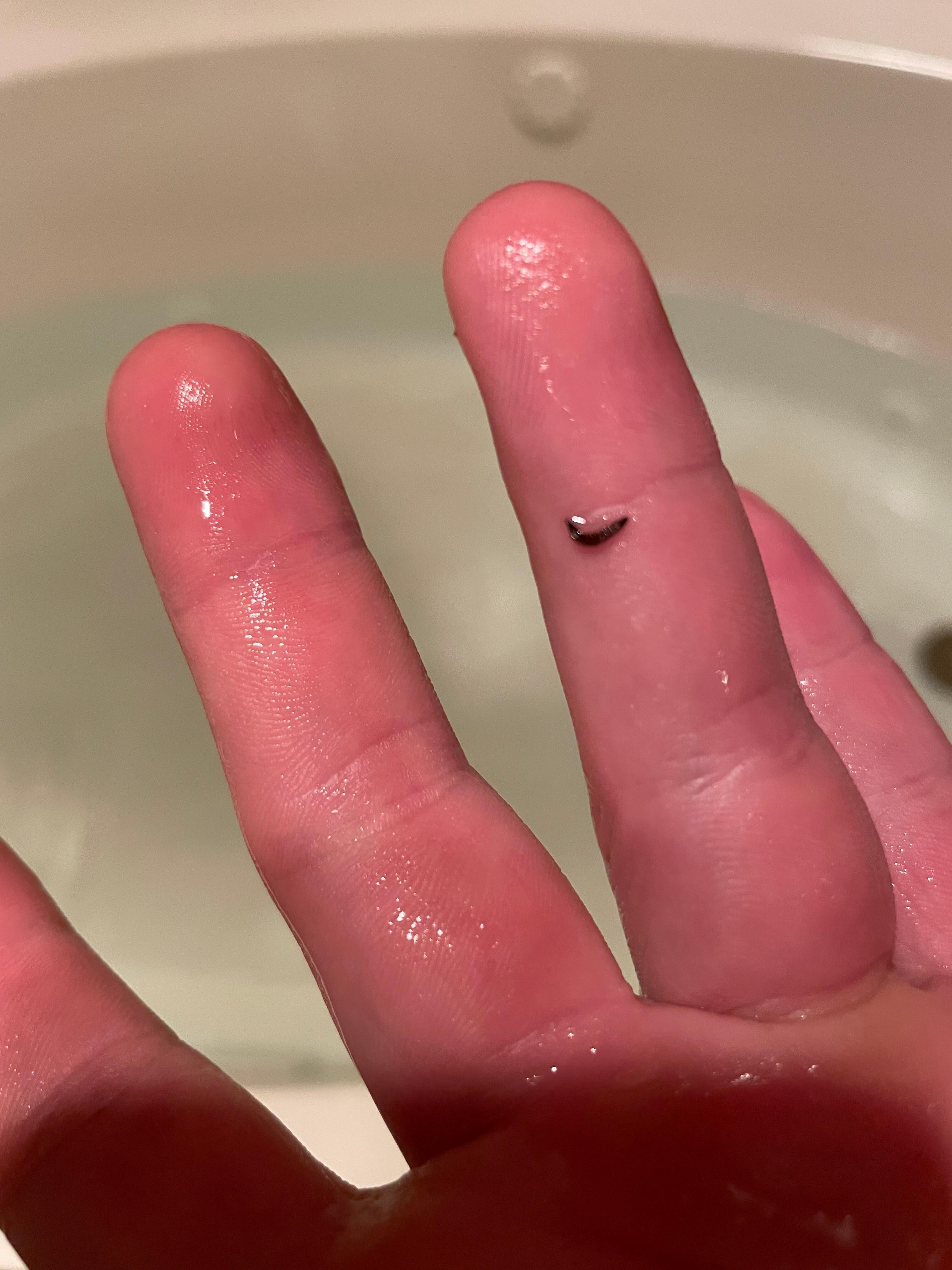 One of the worms in the jacuzzi