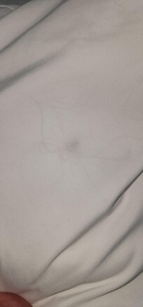Hairs inside pillowcase