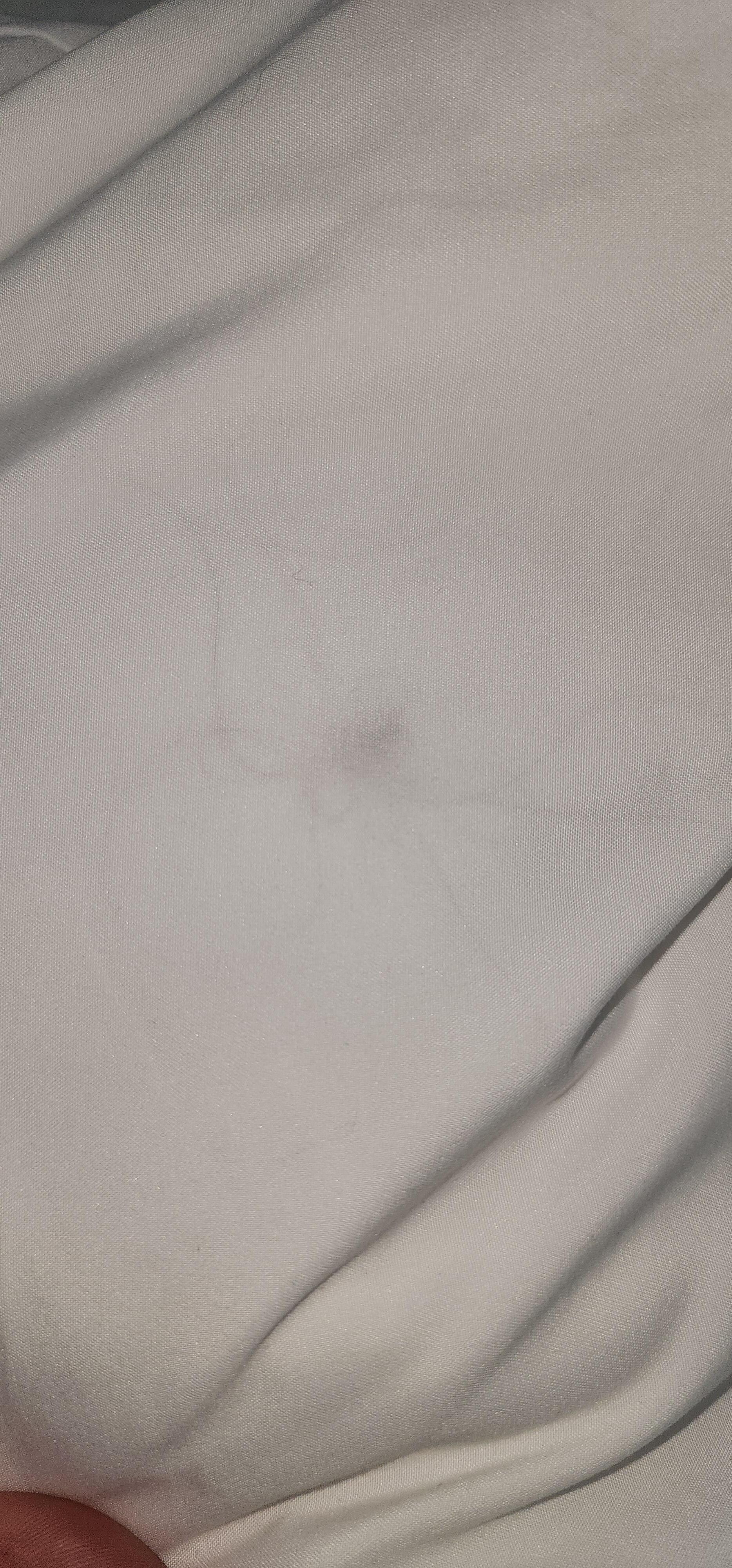 Hairs inside pillowcase 