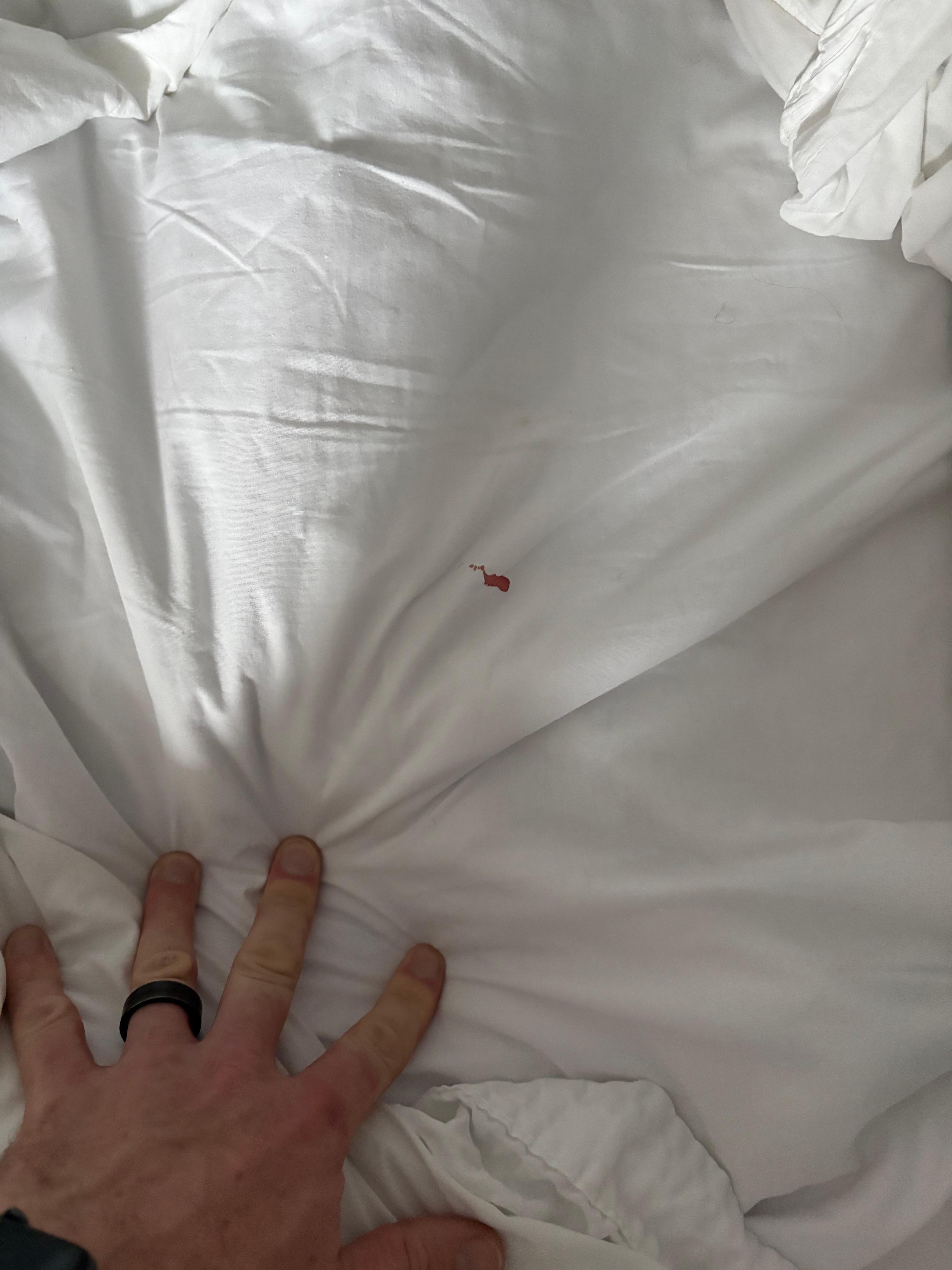 Odd blood spot on bed sheet