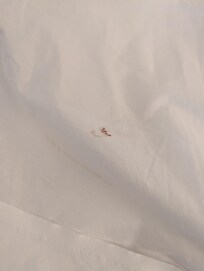 Blood on sheets