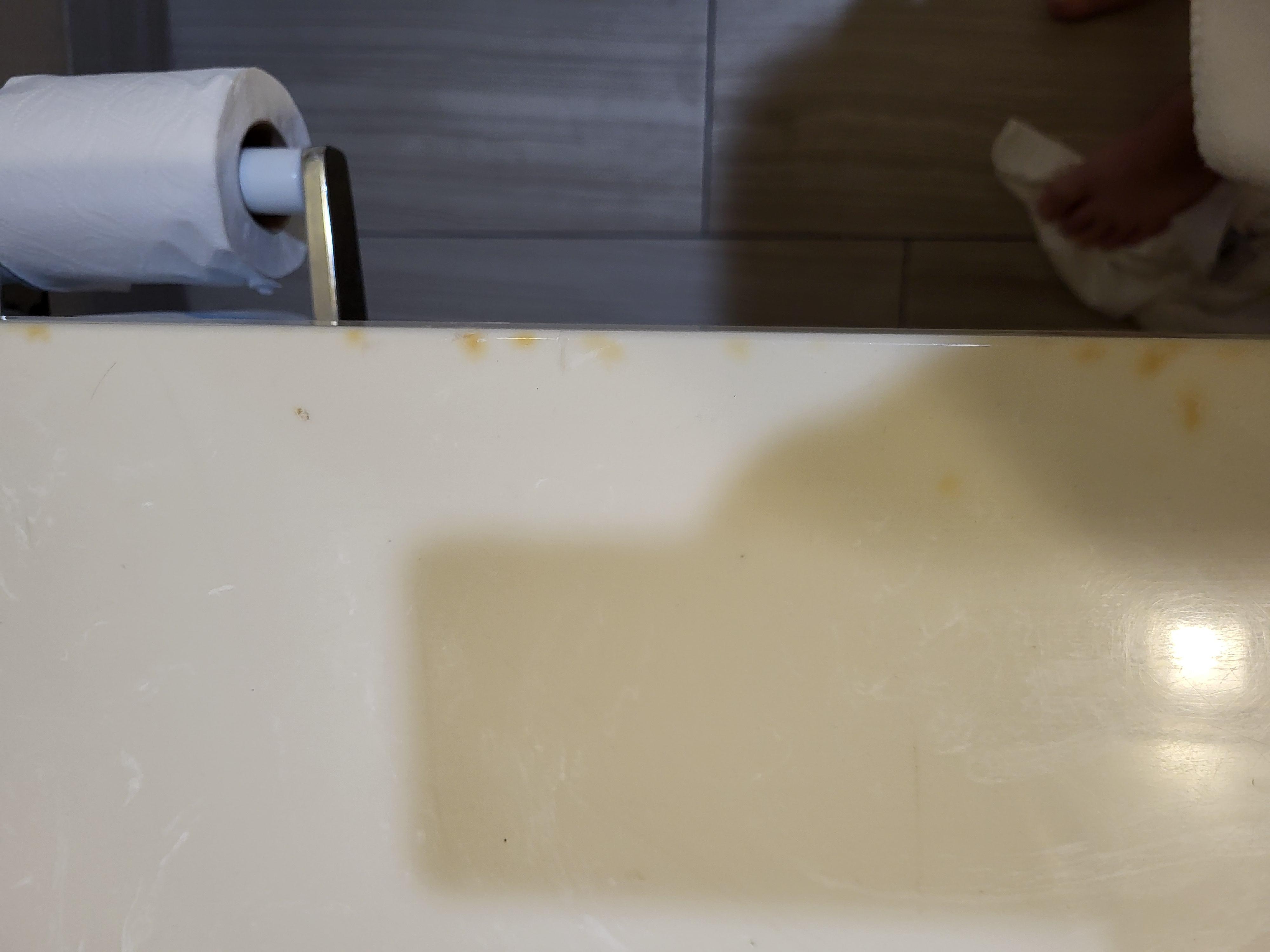 Nicotine stains