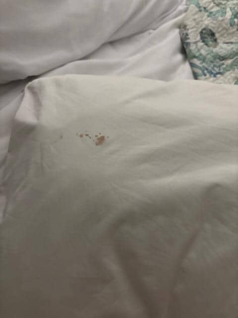 Bloody pillow case 