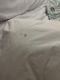 Bloody pillow case