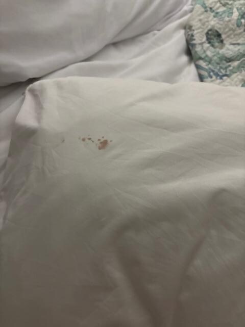 Bloody pillow case 