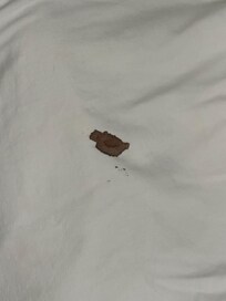 Blood stain on pillowcase