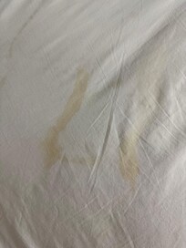 Urine/body fluids wicked up from wet mattress