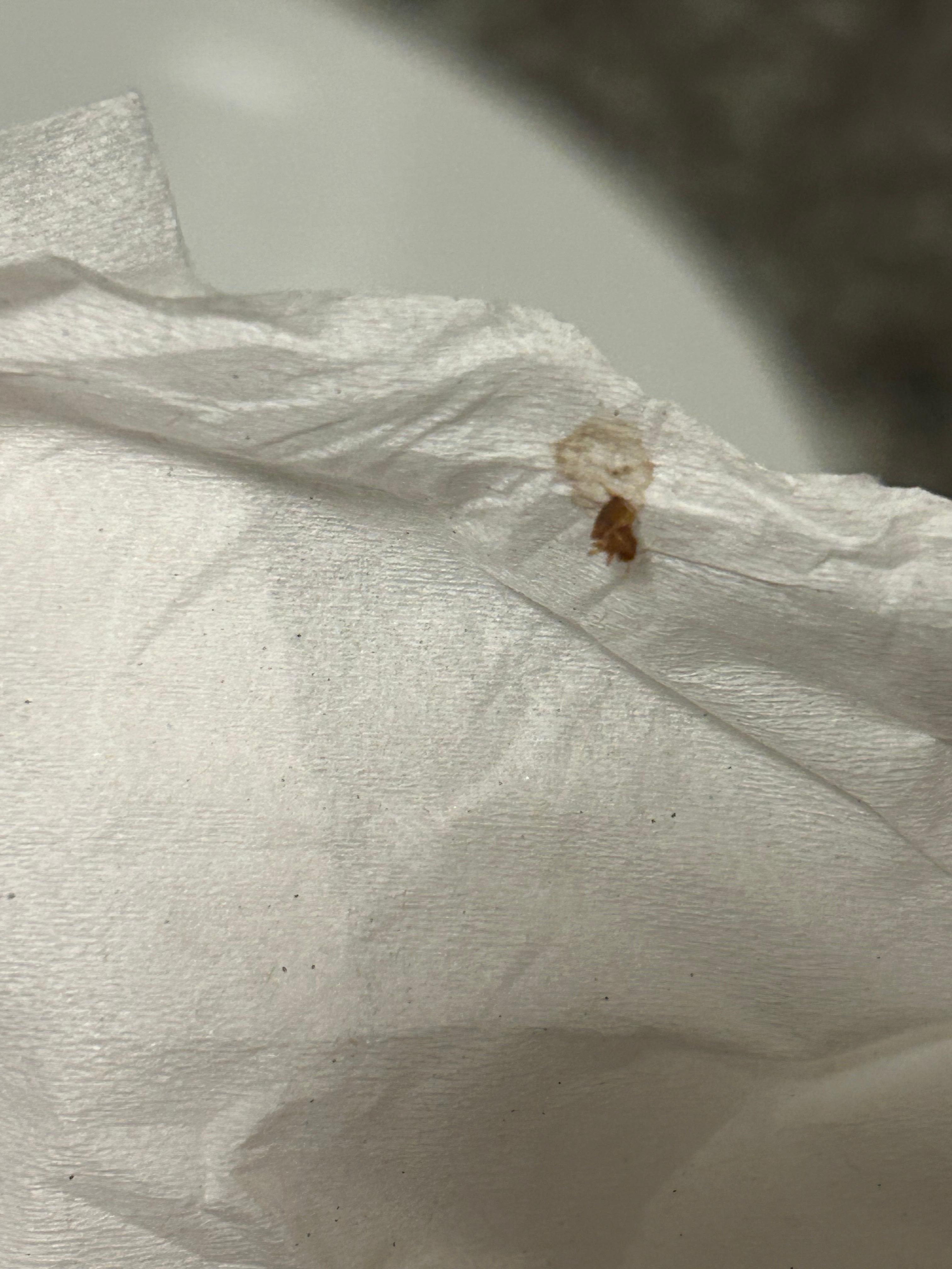 Bedbug I caught 😬