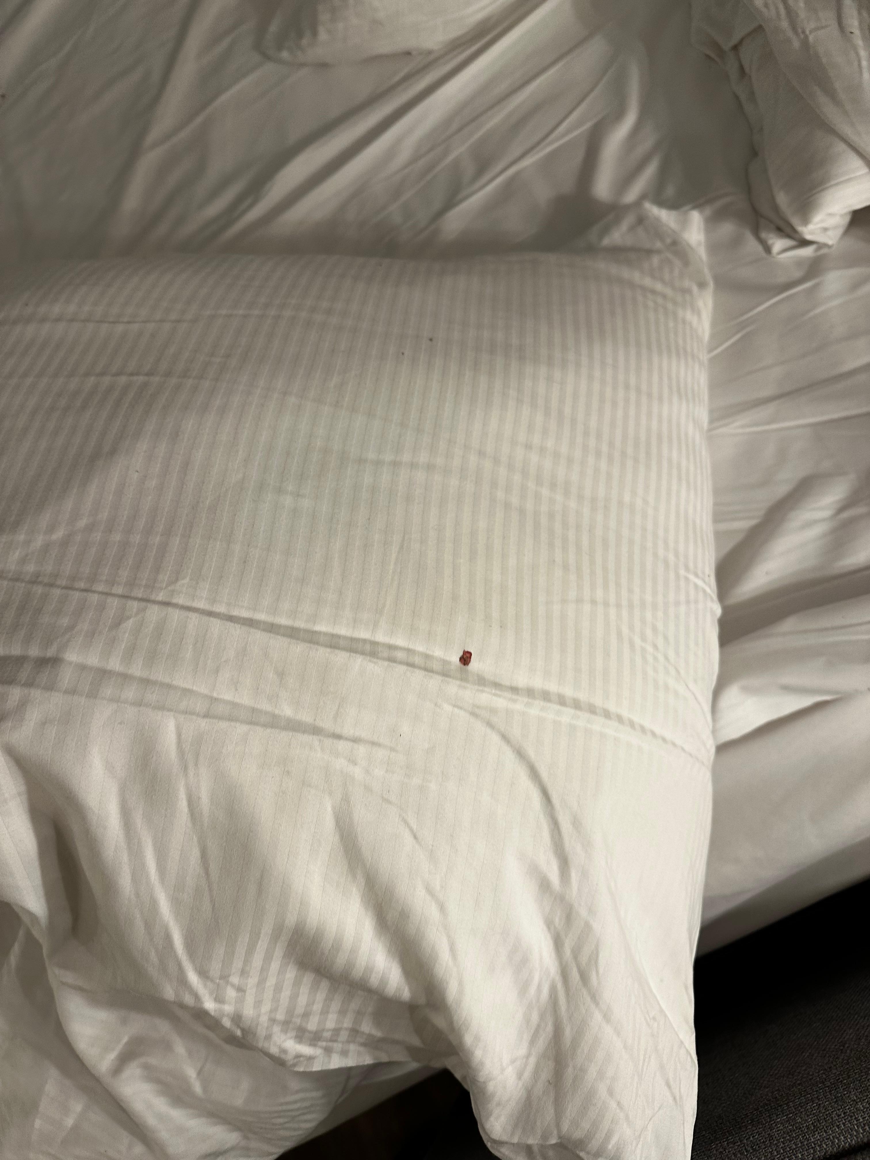 Pulgas por todas partes, un riesgo muy grande a nuestra salud. 