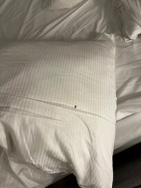 Pulgas por todas partes, un riesgo muy grande a nuestra salud.