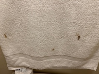 Fecal stain on fresh towel