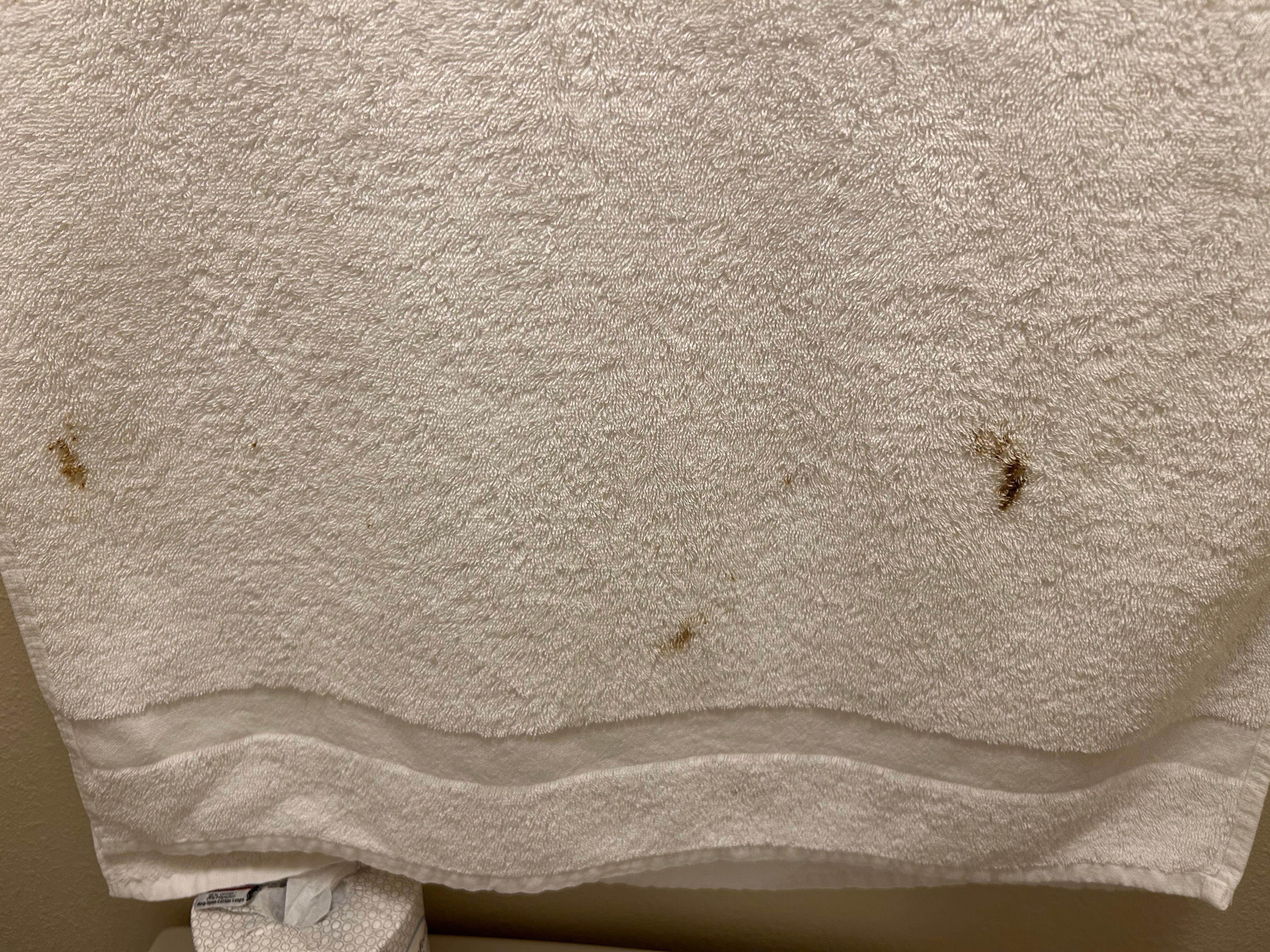 Fecal stain on fresh towel