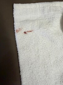 Appears to be blood on a “clean” washcloth.