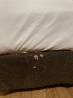 Stains on the bed.