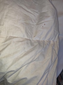 Blood stains on blanket