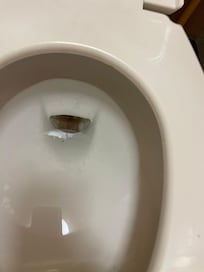 This is how our toilet looks like inside no matter how much we cleaned and bleached it.😩