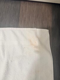 Stains on towels