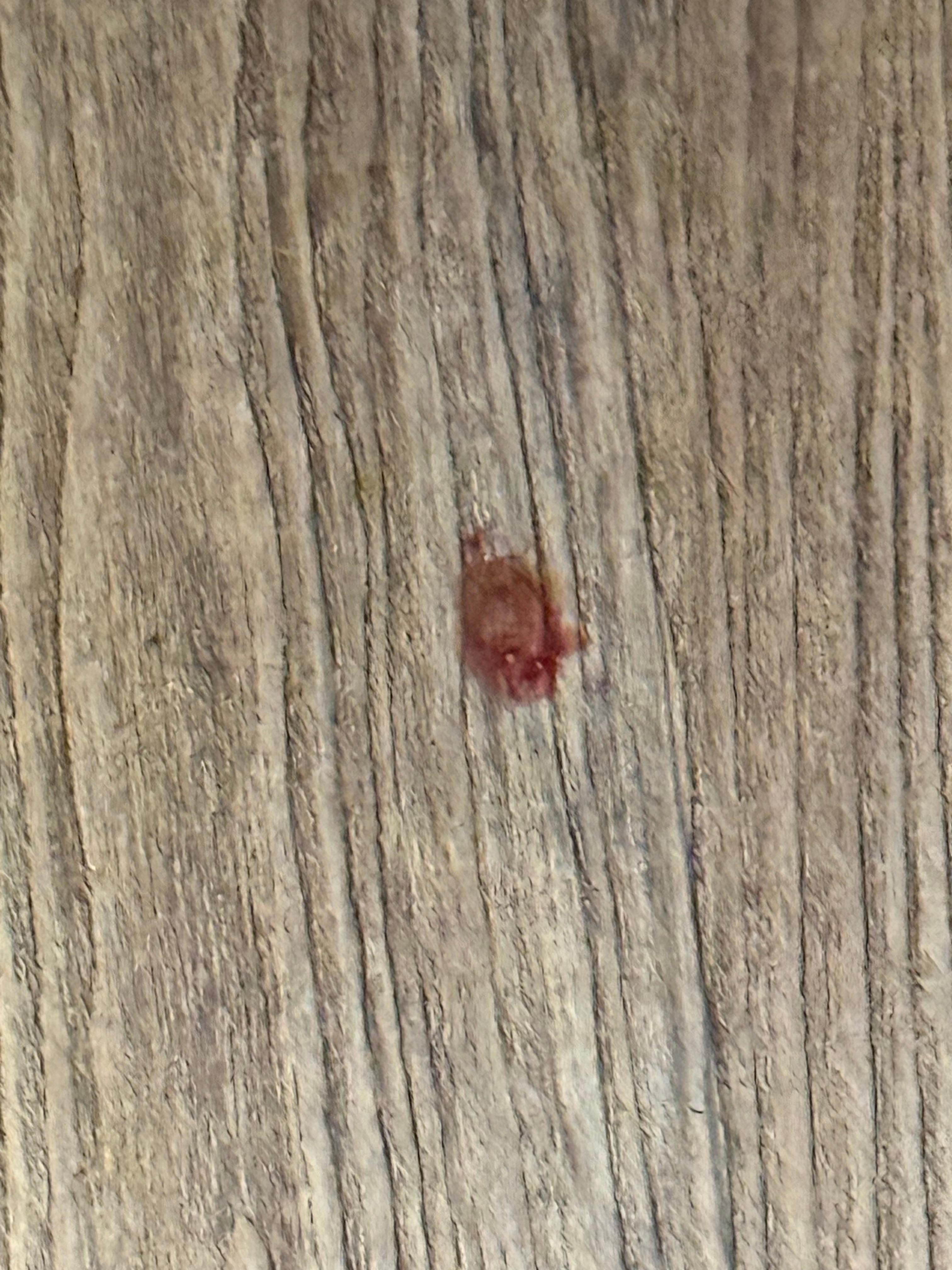 Blood in the floor