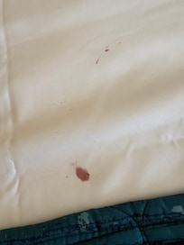 Blood on mattress not ours this was a “clean room”