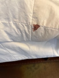 Blood stain on comforter