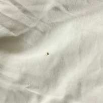 Bed Bug just finished gorging on my arm