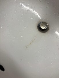 Disgusting sink.