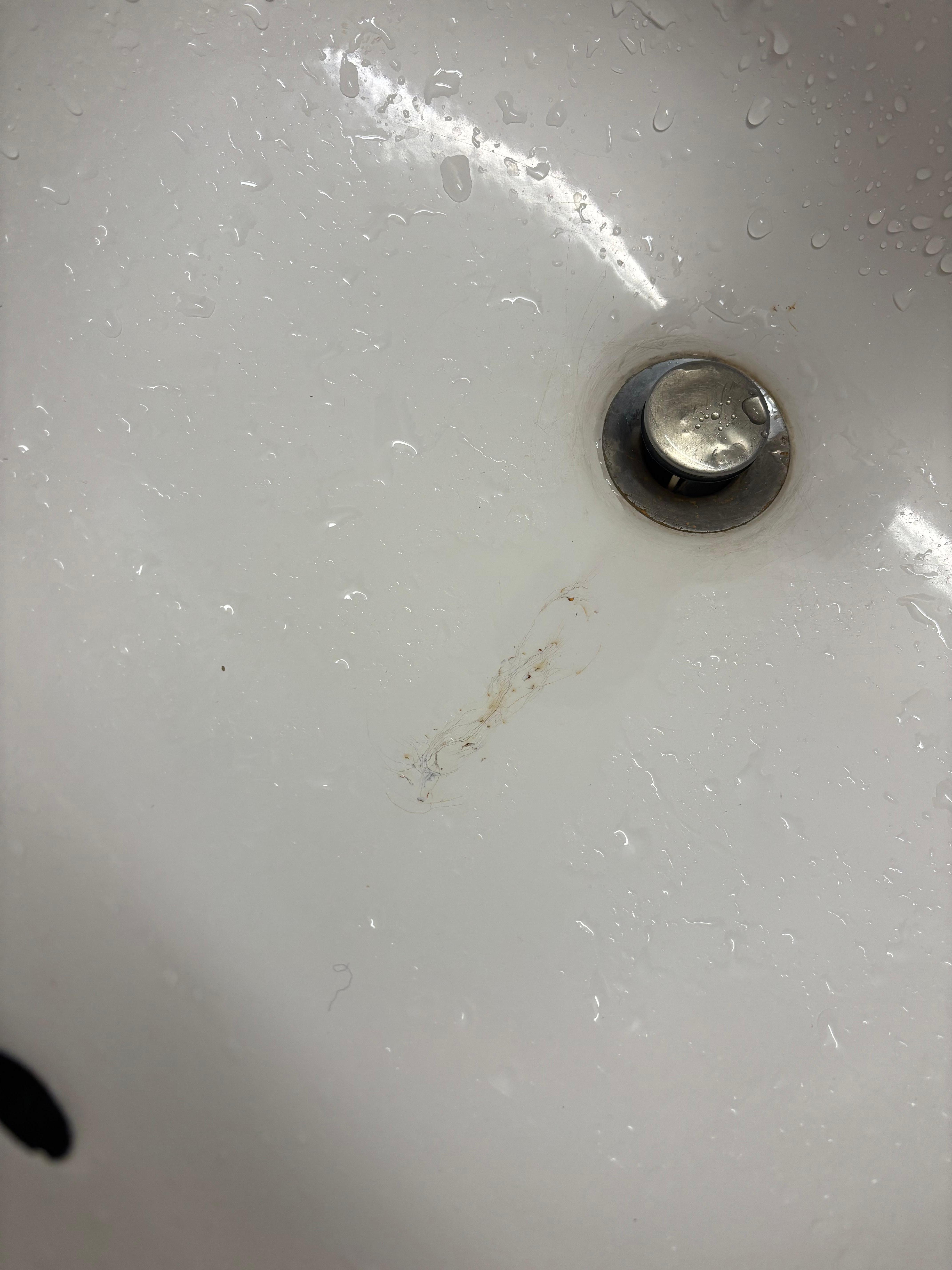 Disgusting sink.