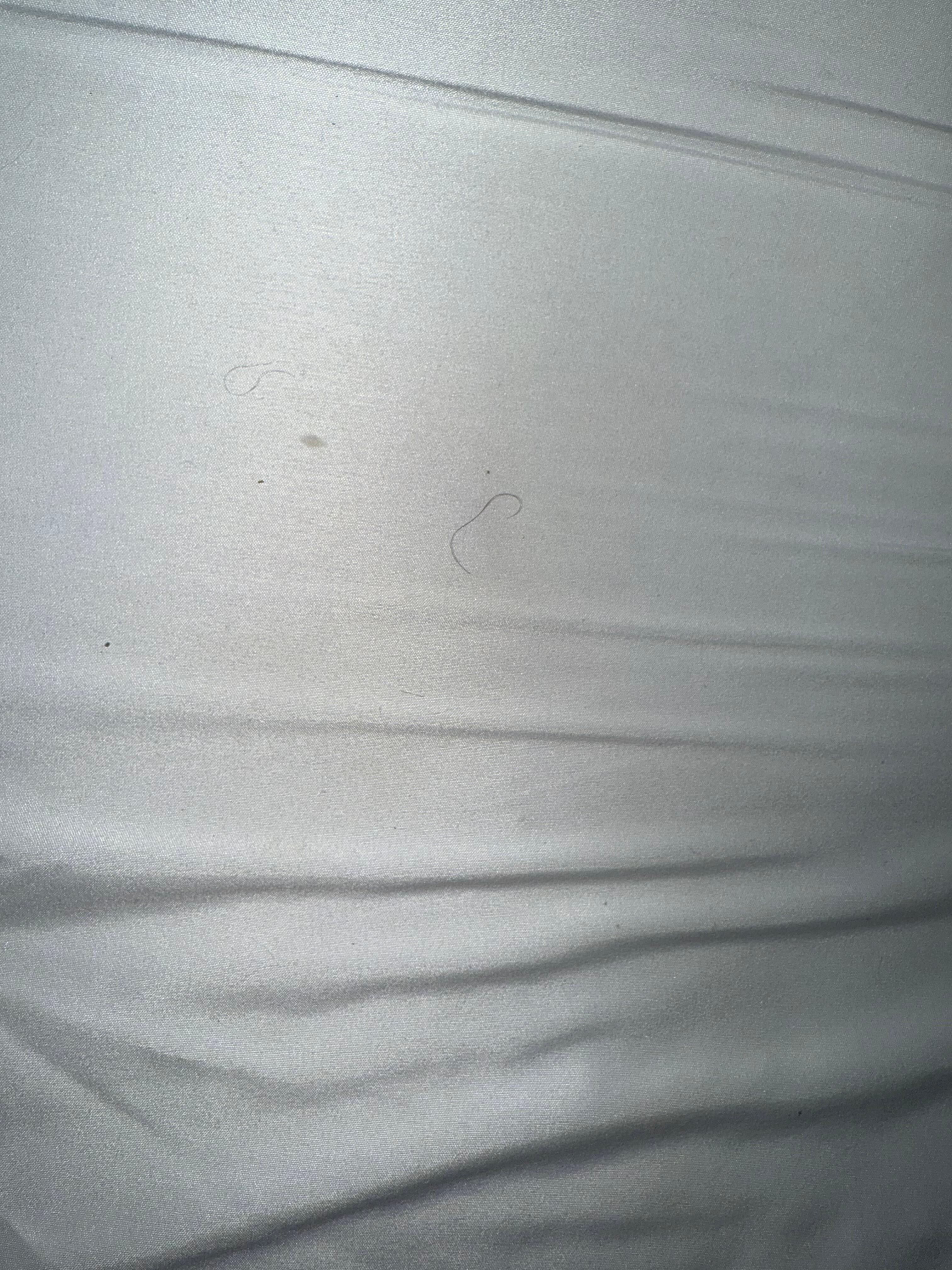 This is 100% pubic hairs!!!! 