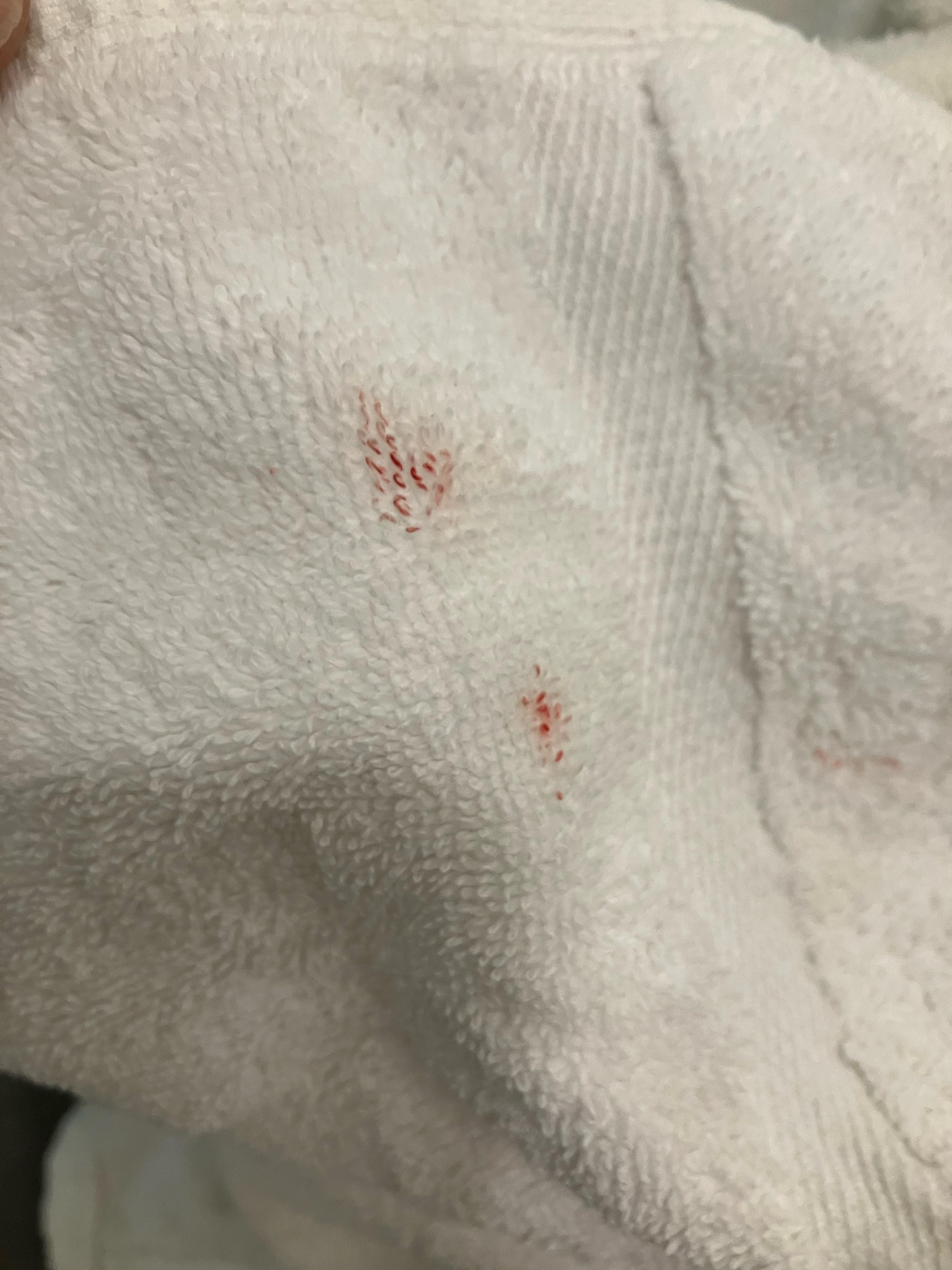 Blood on the folded towel