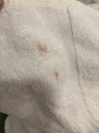Blood on the folded towel