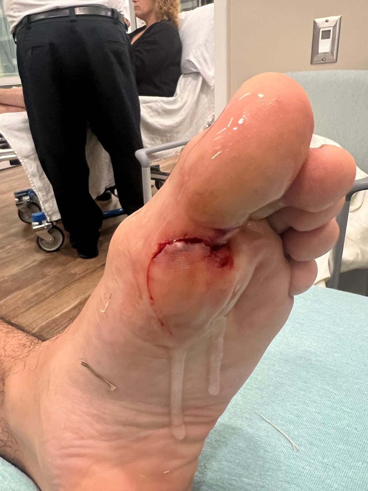 Six hours spent in the ER plus the pain and how it affected his first day of college without being able to walk on his own without crutches.