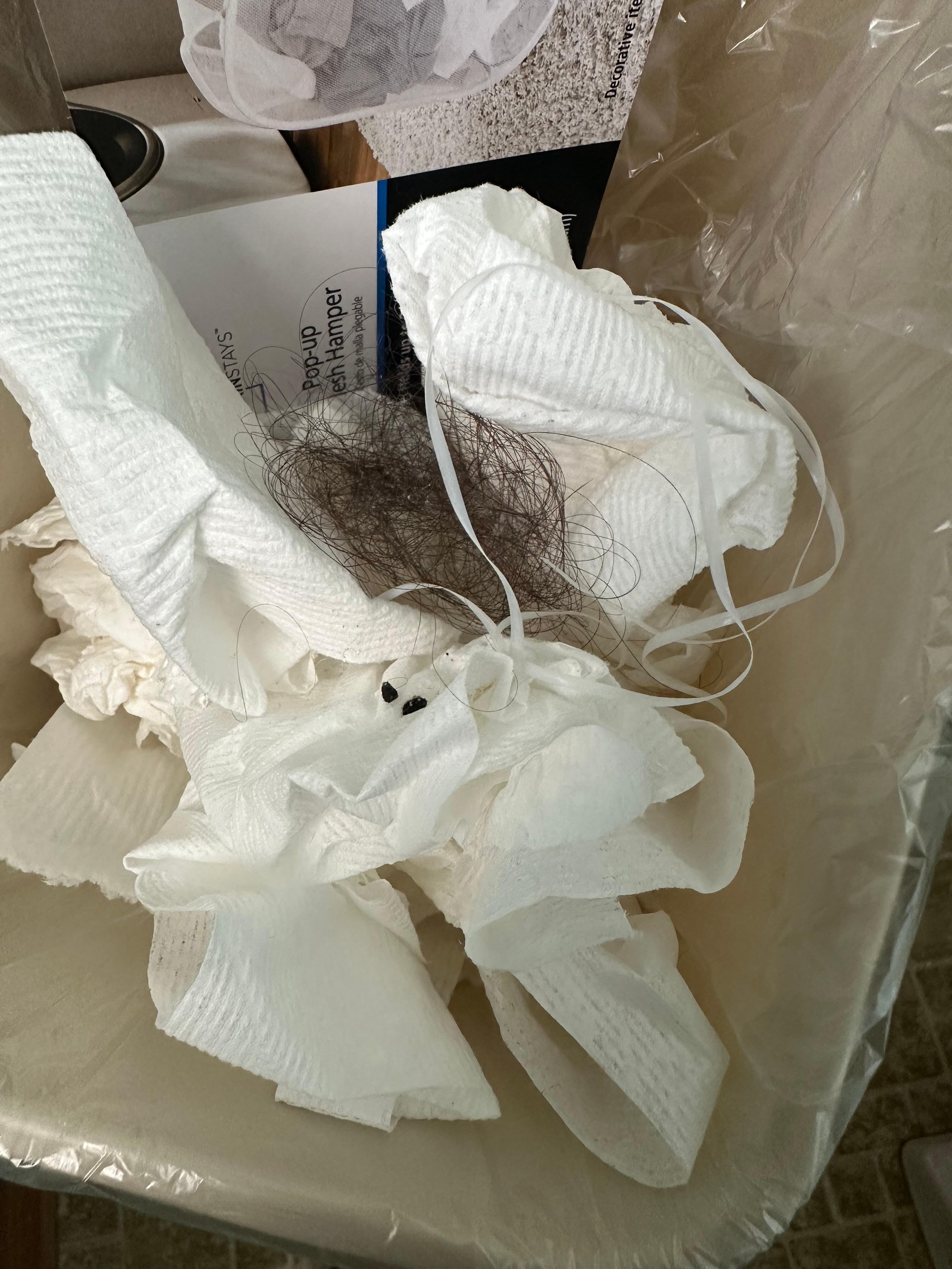 Rat droppings I picked up. Also that ball of hair, I removed it from the mirror on the side of the dresser 