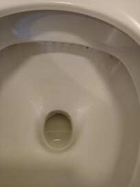 Toilette schmutzig
