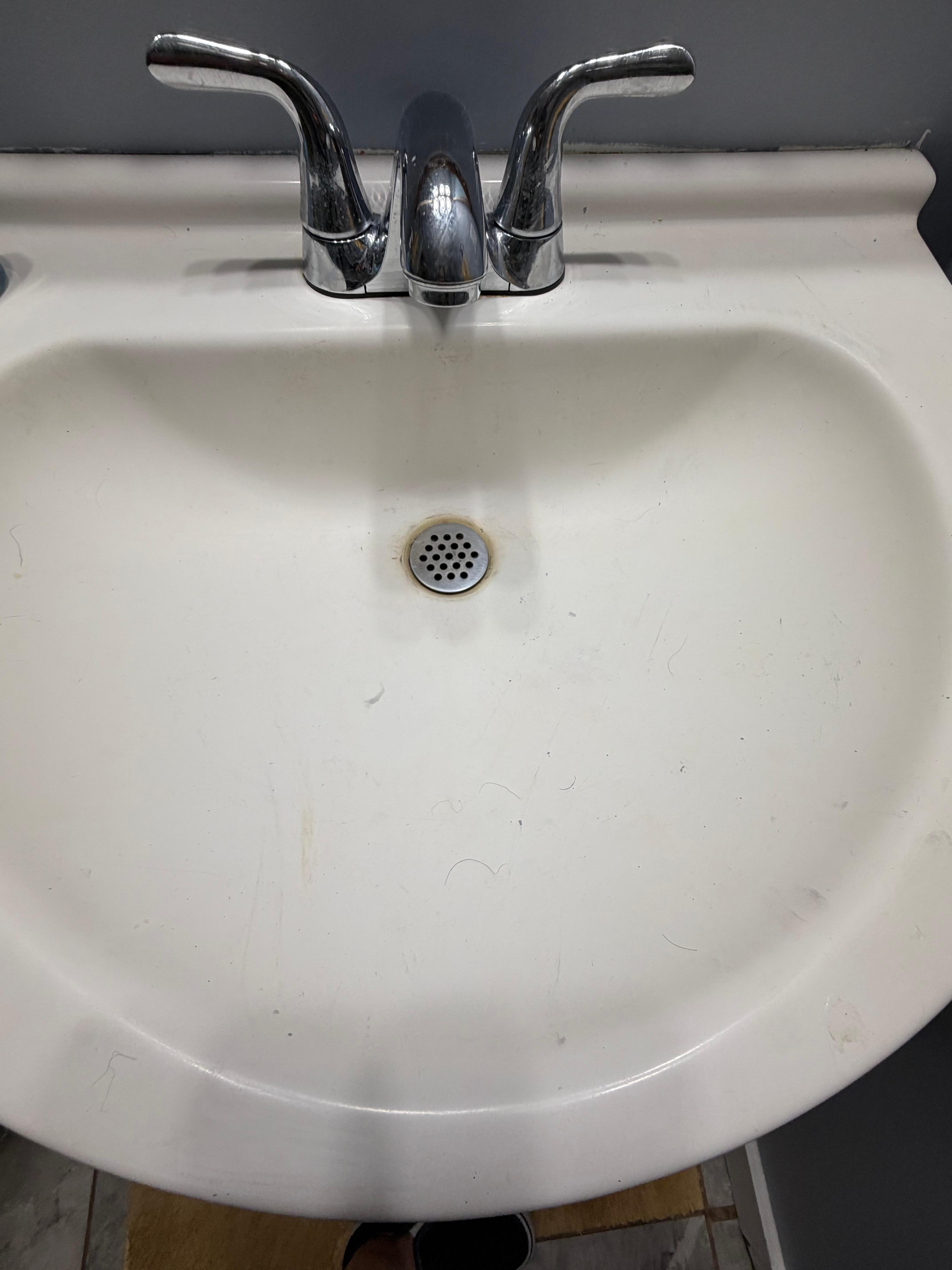 Random hairs everywhere 