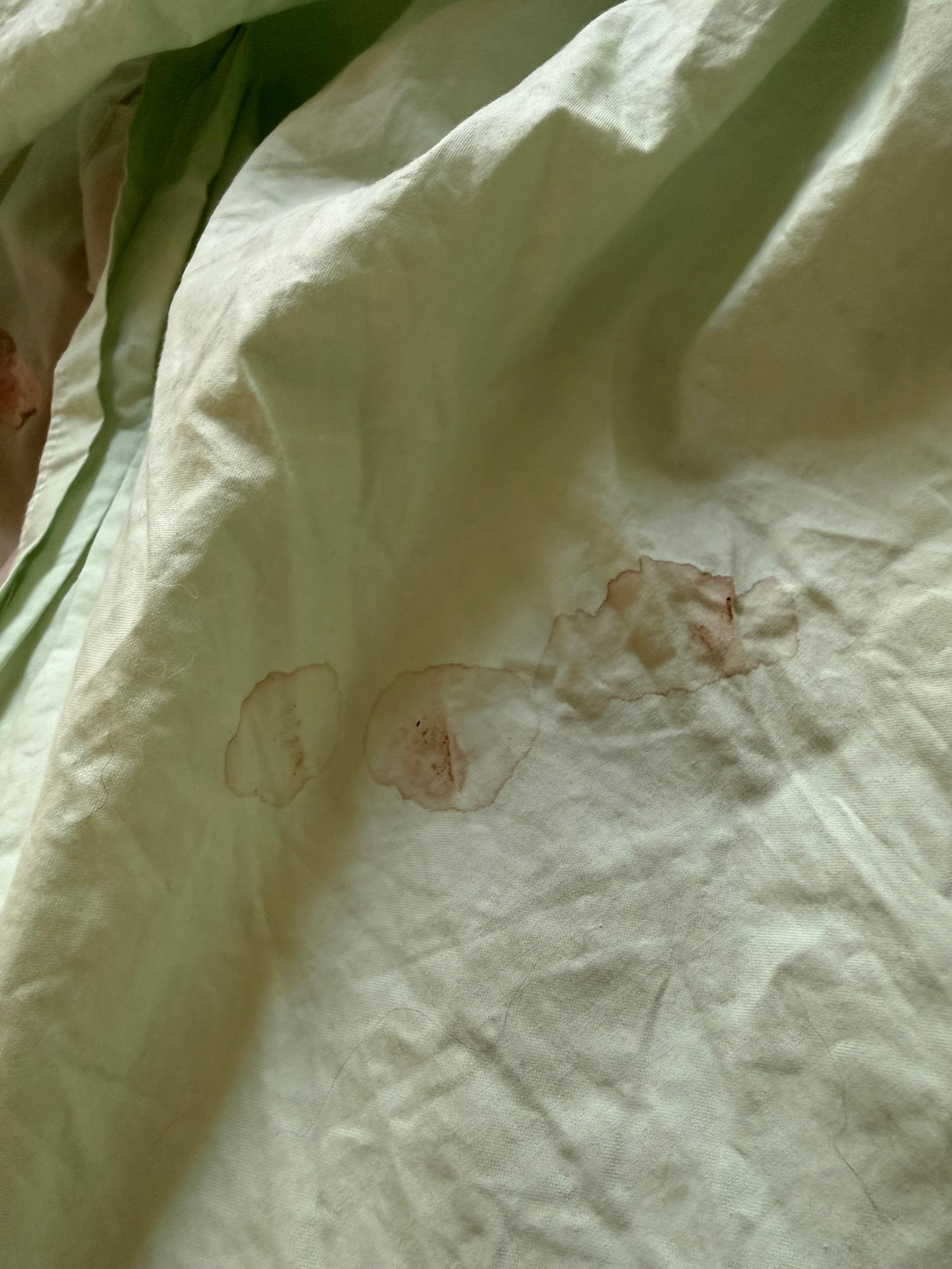 Blood stains on the bedsheets.