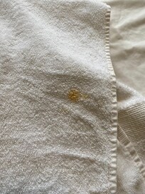 Flecken am Bett und Handtücher