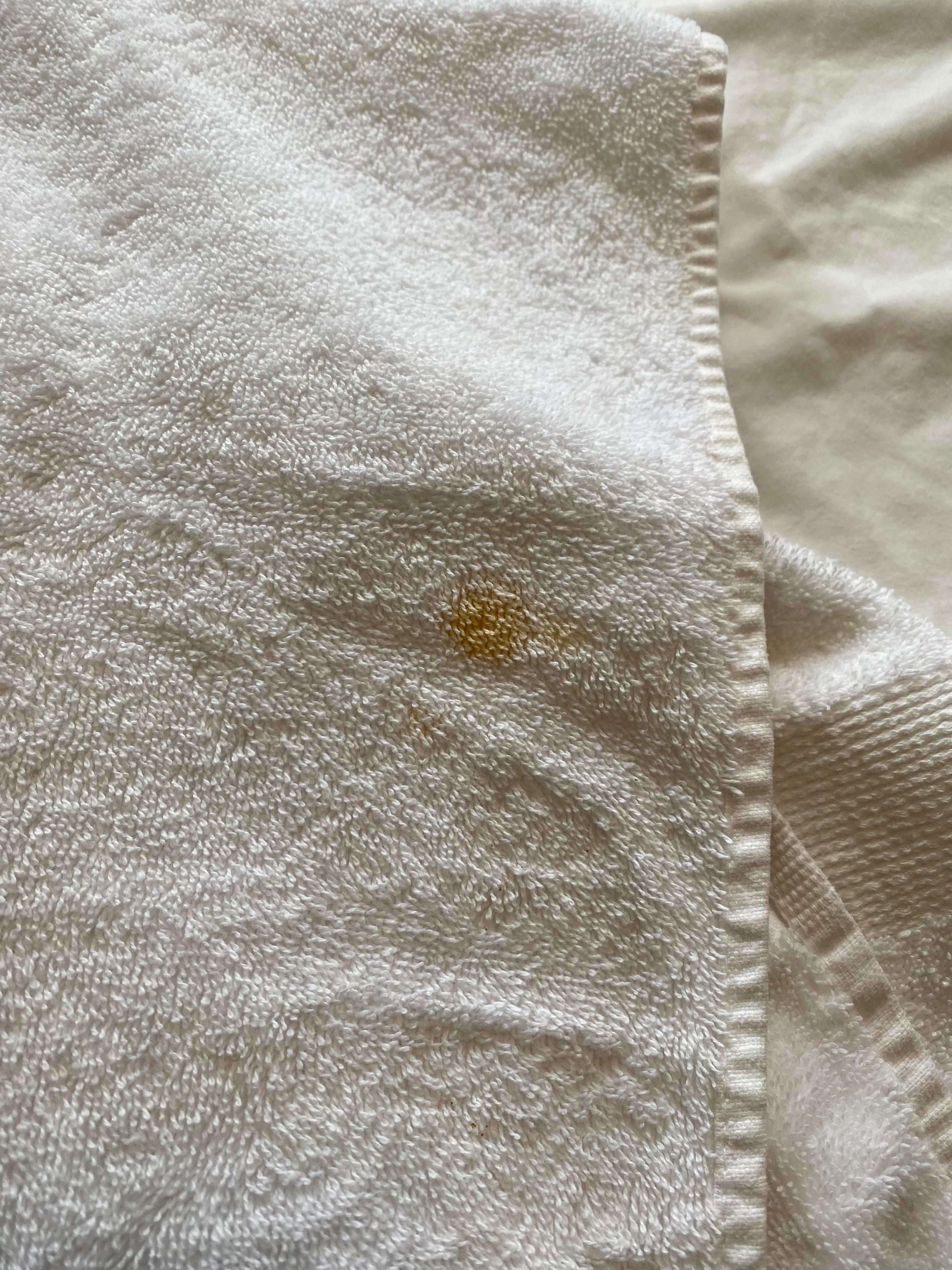 Flecken am Bett und Handtücher