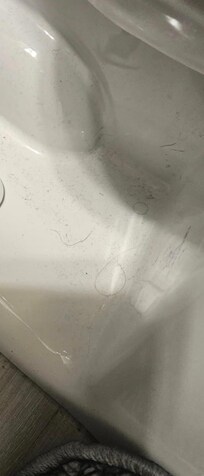 Hairs around toilet.