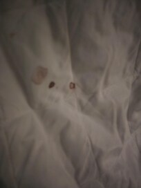 Blood stain linens