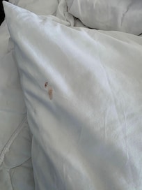 Pillow case dry blood