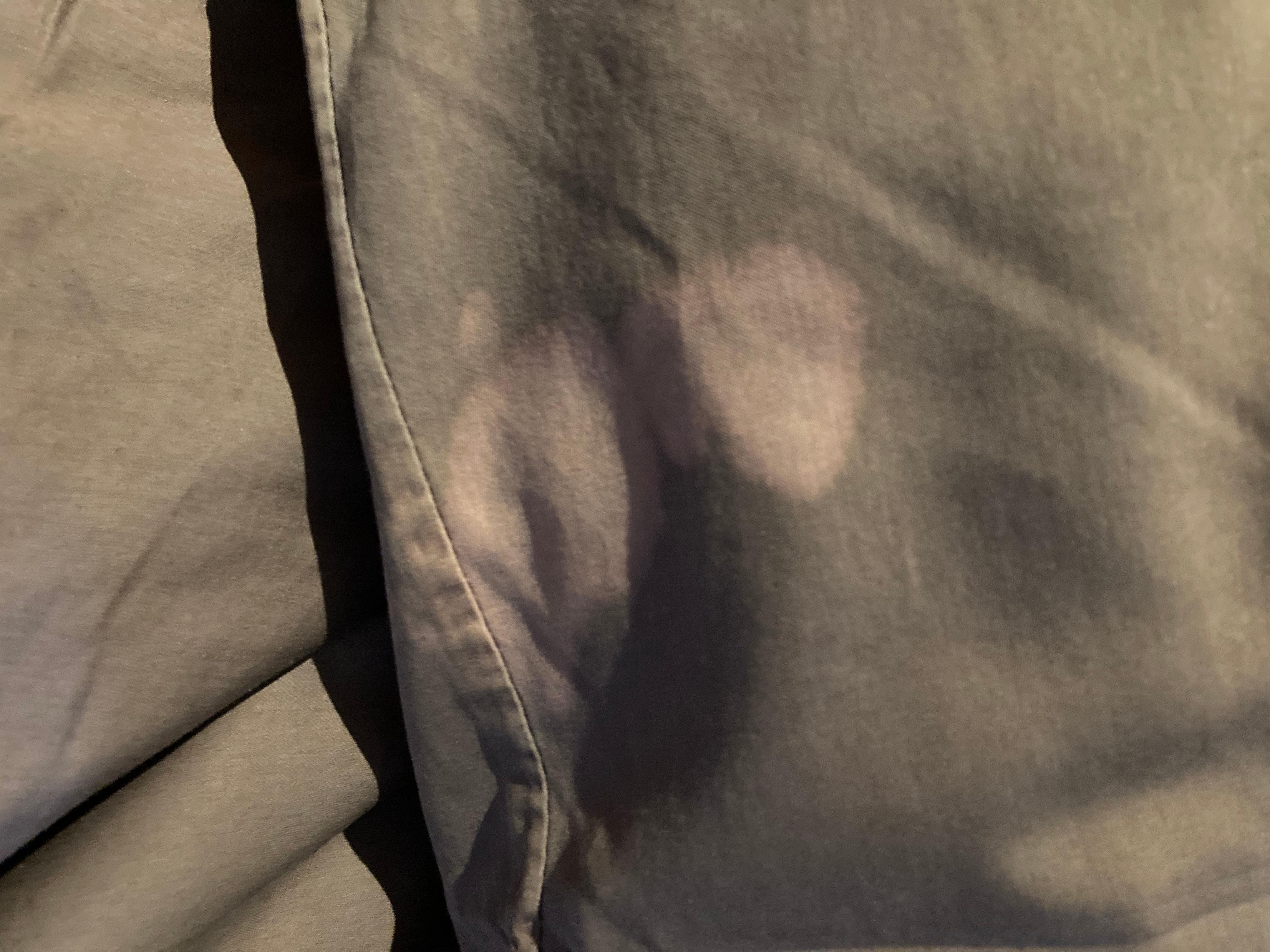 Marks on pillow