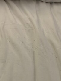 Pubic hairs and bodily fluids