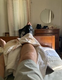 Here is my friend's injured leg. The doctor advised 20 min. of compress 3x/day, and it can take up to 6 mos. to heal.