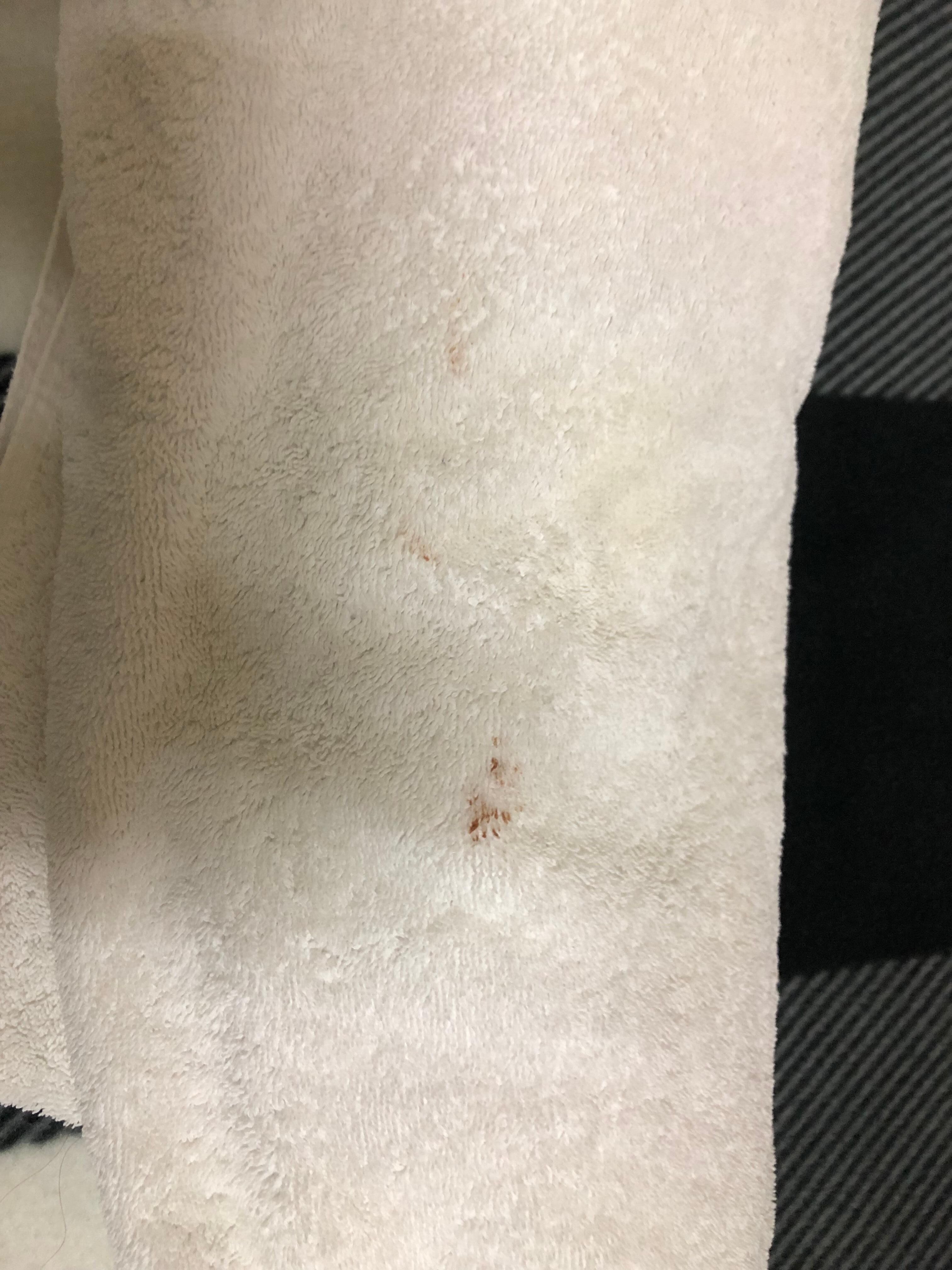 A towel with “just a burn” on it that the hotel wouldn’t replace. 