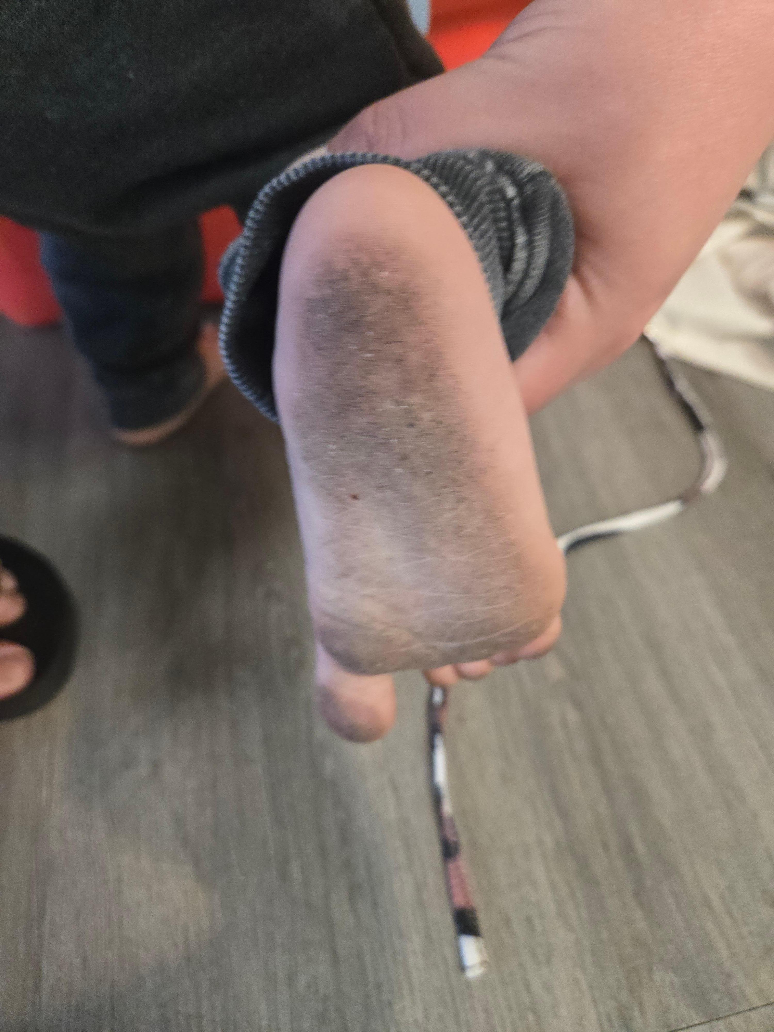 Dirty feet from the room